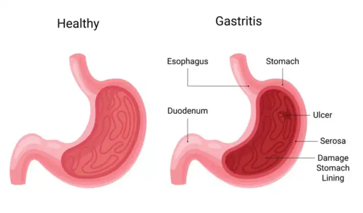 Aloe Freeze-dried Powder Aloe Freeze-dried Powder