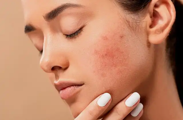 Nattokinase Bulk Nattokinase Bulk