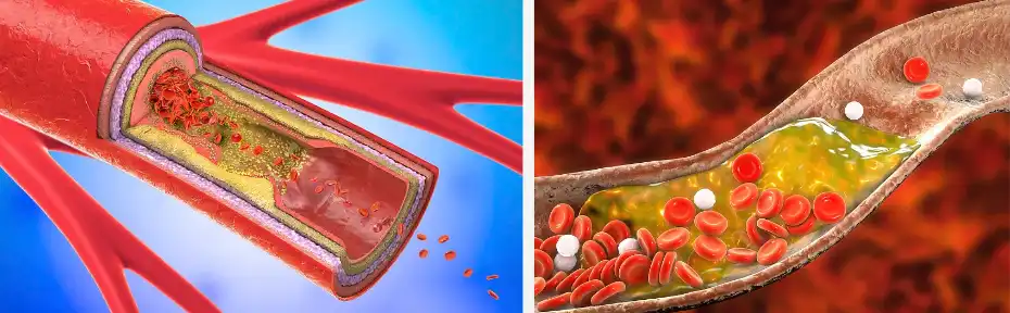 Brassicasterol Brassicasterol