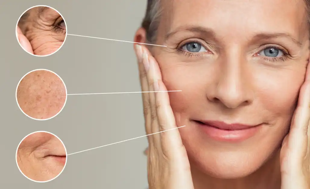 Polygonatum extract Polygonatum extract