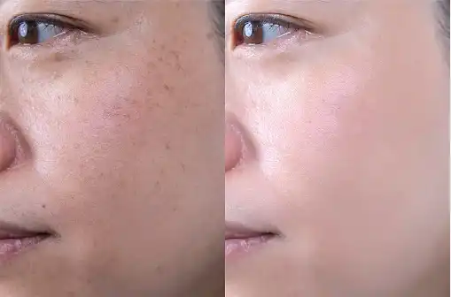 DL-mandelic acid DL-mandelic acid