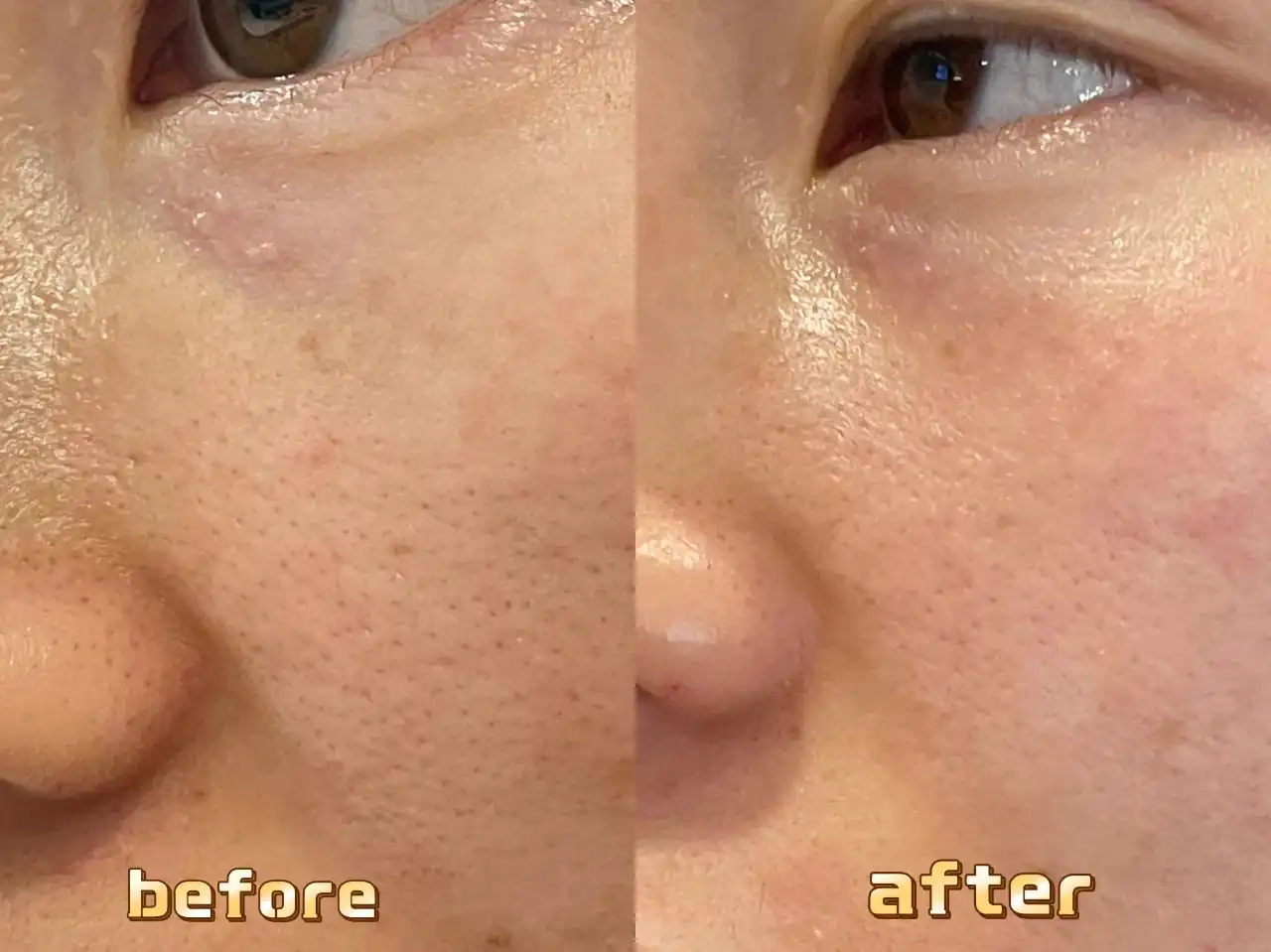 Sponge spicule Sponge spicule