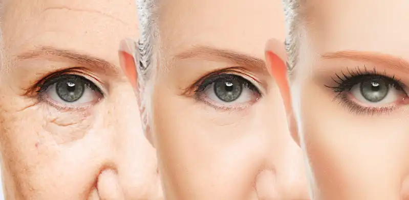 Retinaldehyde Retinaldehyde