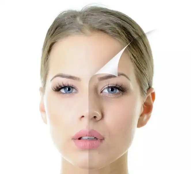 Kojic acid Kojic acid