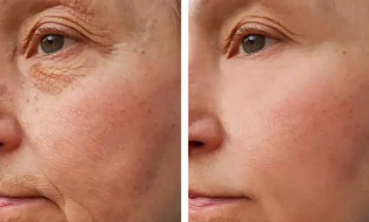 Chlorella Growth Factor Chlorella Growth Factor