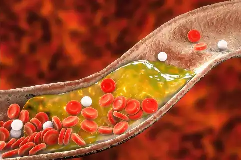 Buckwheat Extract Buckwheat Extract