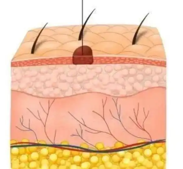Tetrapeptide-30 powder Tetrapeptide-30 powder