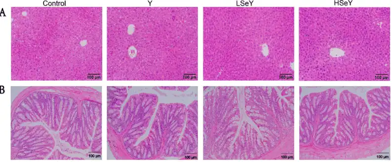 Selenium-enriched yeast