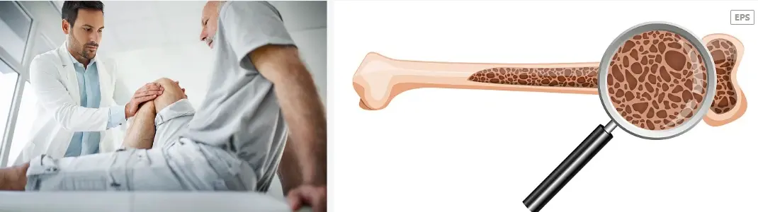 Collagen Type II Powder Collagen Type II Powder