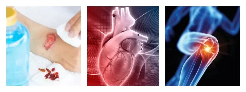 Bulk Saw Palmetto Extract Bulk Saw Palmetto Extract