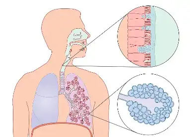 Thymoquinone