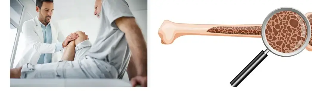 Best Collagen Type II Powder Best Collagen Type II Powder